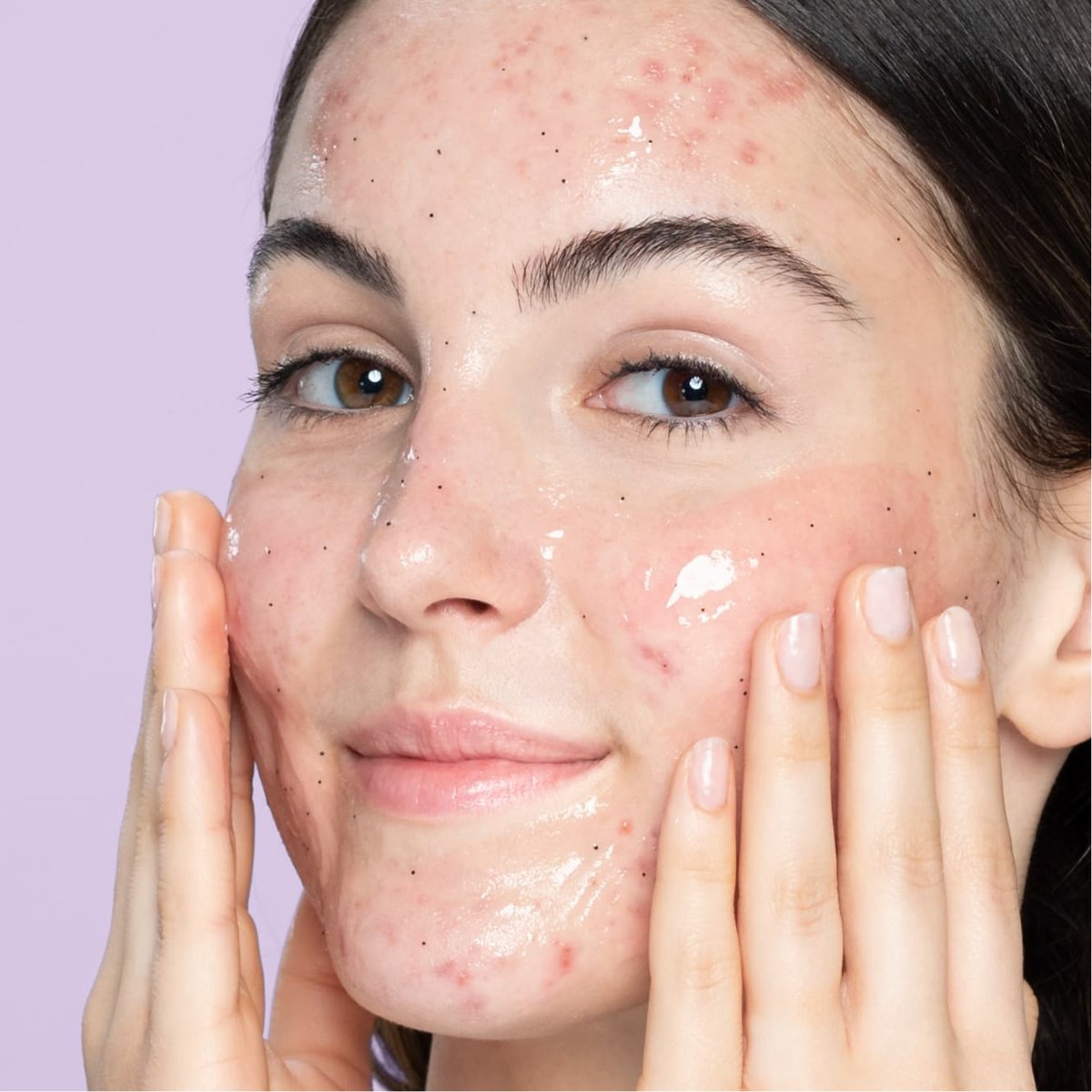 Young teen with brown eyes and brown hair with acne wipes applies watermelon juicy scrub to cheeks in front of purple background
